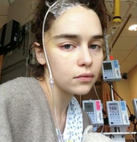 emilia-clarke-photos-brain-surgery-02
